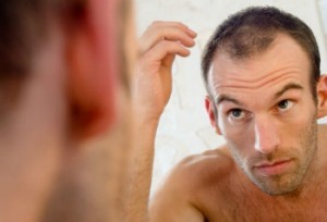 Kapsel voor mannen die kaal worden