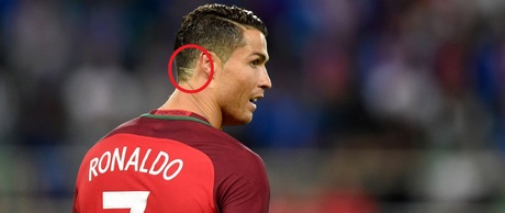 Ronaldo kapsel
